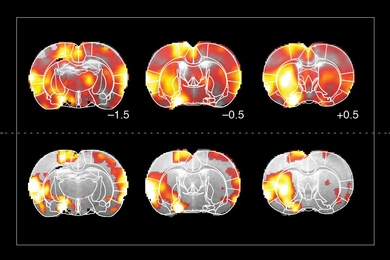 MIT biological engineers have created a specialized sensor that allows them to track dopamine in the brain using magnetic resonance imaging (MRI), as shown in the bottom row. Images in the top row show overall brain activity, as measured by functional MRI.