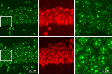 In this figure, neurons in the bottom row, which are missing the HDAC1 gene, show higher levels of DNA damage (green) than normal neurons.