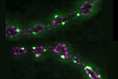 MIT researchers have found that a protein called SYT7 appears to limit activity at neural connections called synapses. Here, synapses glowing light green are engaged in neurotransmitter release. 