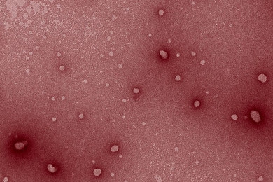An image captured through transmission electron microscopy shows the nanoparticles used to further stimulate the immune system to fight cancer.