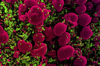 Colorized scanning electron micrograph of an apoptotic cell (pink) heavily infected with SARS-COV-2 virus particles (green). MIT researchers are using computational models of protein interactions to design a peptide that can bind to coronavirus proteins and shuttle them into a cellular pathway that breaks them down.