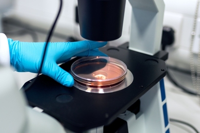 Photo of a gloved hand about to pick up a petri dish on a microscope stage