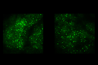 On a black background, neurons lit up in green cluster in large blobs