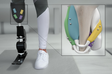 prothetic limb graphic