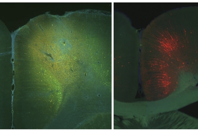 Two microscopic images of brain tissue. On the left the tissue is stained green and on the right the tissue is greenish and red. Both are seen on a black background.