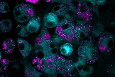 Cyan cells with magenta blobs inside them against a black background