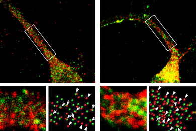 Top two panels show tiny red and green dots (neurons) tightly pushed together in a path, like a rope in varying thickness. 2 bottom panels show blurry red and green splotches, and two show tiny red and green spheres, with arrows highlighting the red spheres.