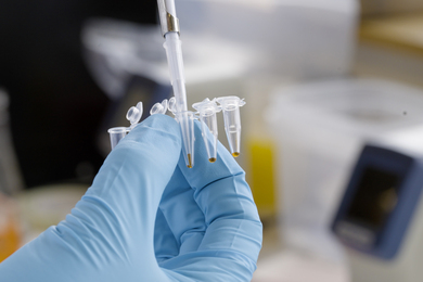 A blue-gloved hand holds a plastic tray, while a pipette adds brown liquid to each container.