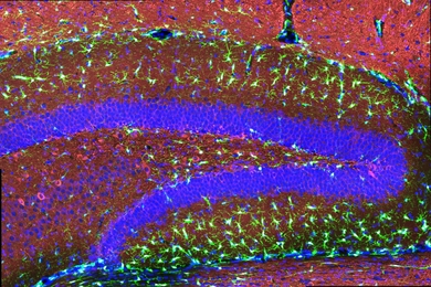 A colorfully stained section of a mouse hippocampus features scores of brightly glowing spiny-looking cells scattered throughout layers of tissue stained in blue and red