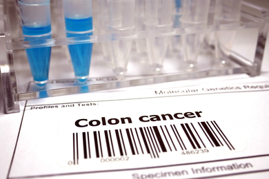 An at-home colon cancer screening test, with barcode that says "Colon cancer" above it.
