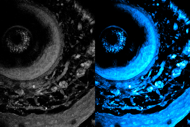 Two images; on left the image is monochrome and blurrier. On right, the image is in blue and shows more of the cellular objects.