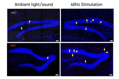 2 by 2 grid of panels that each show a hairpin-like shape of blue stained cells. Left column is labeled "Ambient light/sound." Right column is labeled "40Hz Stimulation." Panels in the 40Hz column show more arrows pointing to white blotches than the panels in the ambient column.