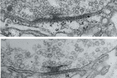 Two stacked electron microscope images show a synapse. A dark T shape features among many tiny bubble-like circles. In the bottom image the T shape is much bigger than in the upper image.