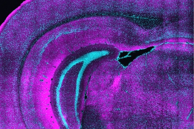 Cross section of mouse tissue that appears perfused with magenta and cyan staining.