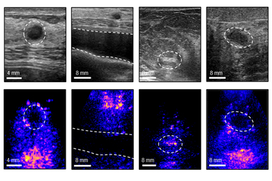 Eight ultrasound images, in two rows, compare the old (top) and new (bottom) methods. The bottom row is in color and is more clear.
