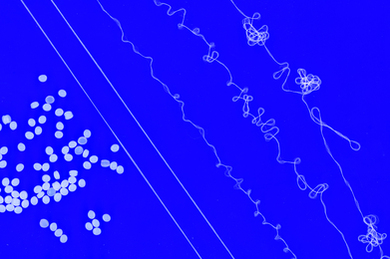 On a blue background: Dozens of tiny resin pellets, and then five strings of yarn that get more spaghetti-like.