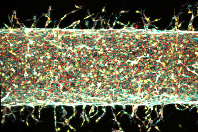 Blood vessels