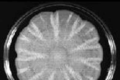 A yeast culture that Dr. Todd Reynolds grew in a Jello-like medium spreads out, forming beautiful floral patterns. Yet when the same yeast was grown on plastic, it formed biofilms, which are potentially dangerous.