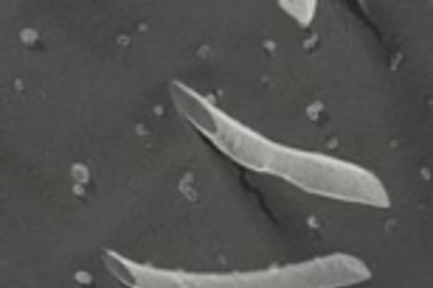 Image of peptide nanotubes.