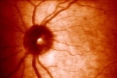 "Glowing Retina," a retina print by Elizabeth Goldring.