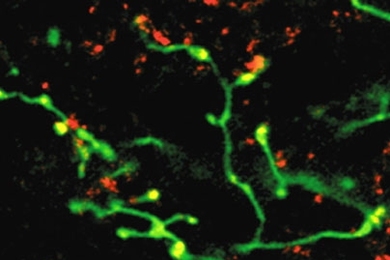 This confocal microscopy image shows activity in the rat brain, with the retinal nerve pathway showing green and the functional synapses appearing yellow.
