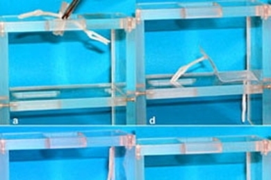The series above illustrates the triple shape effect of a fastener consisting of a plate with two anchors prepared from CL(50)EG: Starting at 20 degrees Celsius, the device, in an easily-handled form, is put into a scaffold, right, which might be difficult to access (a). Increasing the temperature to 40 C triggers unfolding and positioning into the cavity, left (figures b to d). Increasing the ...