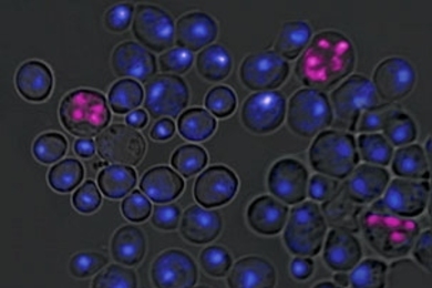 Haploid cells, which contain one copy of each chromosome, should not undergo further reduction of their chromosome number (through a type of cell division called meiosis). To prevent such a catastrophic event, haploids block the production of a protein called IME4, which triggers meiosis, by expressing antisense IME4. Failure to block sense IME4 results in the aberrant meiotic events shown above i...