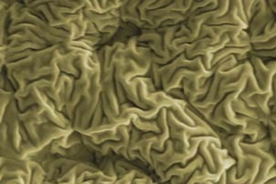 Wrinkled hard skin on polymer surface induced by focused ion beam. The wrinkles are hierarchical with the primary wavelength of 465 nm.