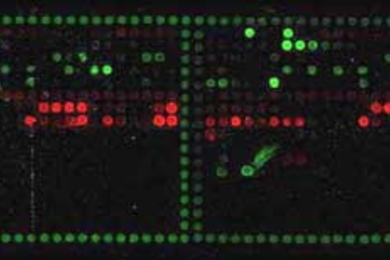 These peptide arrays--glass slides covered with thousands of tiny protein fragments--were used to observe the formation of the long fibers key to certain neurodegenerative diseases.