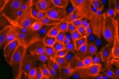 Grown in a newly invented culture medium, these normal human breast cells (whose membranes are stained red) form sheets.