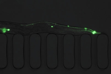 This photo shows an immobilized C. elegans worm inside the new microfluidic chip designed at MIT. The green spots are neurons.