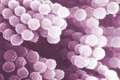 A scanning electron micrograph of one of the 
seventeen fungal species analyzed in the study.