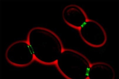 Fluorescent micrograph (scale bar: 10 micrometers) shows yeast cells (red) with septin (green), which enables the budding of daughter cells. MIT researchers have found septin also helps neurons sprout the branch-like protrusions used to communicate with other neurons.Â
