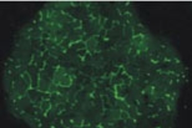 Liver cells in the micropatterned co-culture form tube-like structures (shown here in green) that resemble bile capillaries found in a human liver.
