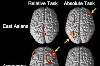Brain activity in East Asians and Americans as they make relative and absolute judgments. The arrows point to brain regions involved in attention that are engaged by more demanding tasks. Americans show more activity during relative judgments than absolute judgments, presumably because the former task is less familiar and hence more demanding for them. East Asians show the opposite pattern.