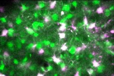 A field of neurons (green) and astrocytes(purple) within visual cortex, visualized by high-resolution two-photon imaging in the intact brain. The astrocytesare labeled with the marker dye SR101, and both neurons and astrocytesare subsequently labeled with the calcium indicator OGB1.