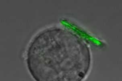 MIT researchers have developed a technique to attach tiny polymer "backpacks" to cells. This immune system cells, a B lymphocyte sports one. The scale bar is 10 micrometers.
