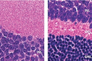 MIT researchers found that mice with normal DNA repair systems had more retinal degeneration upon exposure to environmental toxic agents than mice lacking a certain DNA repair system.  At right, the cross section of the retina from a mouse lacking the repair system is normal. At left, mice with too much DNA repair have greatly reduced numbers of cells in the OPL (outer plexiform layer) and ONL (ou...