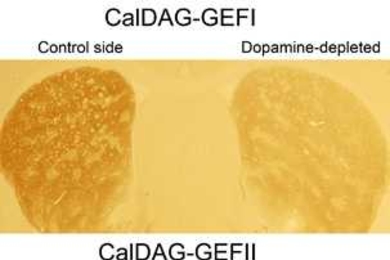 The Graybiel Lab caused Parkinson's disease in rats by depleting dopamine in the right side of the striatum, the brain region that drives the abnormal movements in the disease, leaving the left side as the control. Treating the rats with L-DOPA induced dyskinesia...