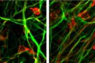 Whitehead Institute researchers reprogrammed human skin cells from Parkinson's disease patients into an embryonic-stem-cell-like state. After removing the reprogramming genes, the scientists used these so-called induced pluripotent stem (iPS) cells to create dopamine-producing neurons, the cell type that degenerates in Parkinson's disease patients.Â To confirm that the iPS cells had become dopam...