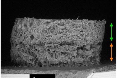 MIT and Cambridge University scientists developed this tissue scaffold that could help repair knees and other joints. The top section, indicated by the green arrow, stimulates bone growth, while the lower half, marked by the orange arrow, stimulates cartilage growth.