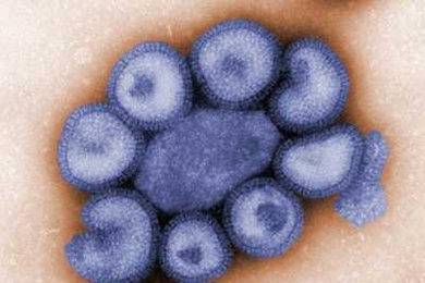 This colorized negative-stained transmission electron micrograph (TEM) depicts the ultrastructural details of a number of influenza virus particles, or “virions."