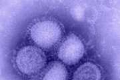 The H1N1 "swine" flu.