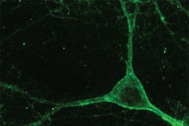 Mouse neuron expressing Arch gene