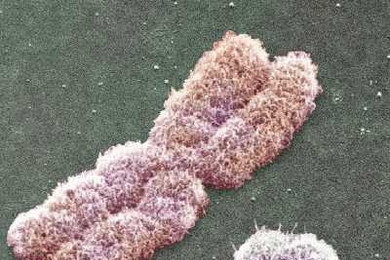 The Y chromosome, right, is dwarfed by the much larger X chromosome.