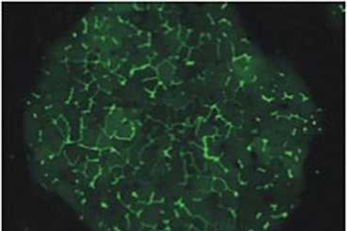 Liver cells in a micropatterned co-culture form tube-like structures (shown here in green) that resemble bile capillaries found in a human liver.