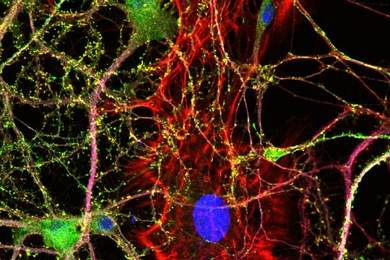 MIT neuroscientists have shown that the protein Arc is necessary for neurons like this one to adjust their responses to new sensory stimuli. (The blue circle is the neuron’s nucleus, and the red strands are actin filaments.)