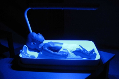 A device for newborn infants with jaundice delivers phototherapy to treat the condition