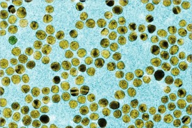 An image of gold nanoparticles.