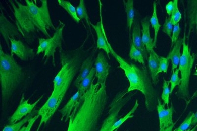 MIT researchers used RNA to induce these fibroblast cells to express four genes necessary to reprogram cells to an immature state.